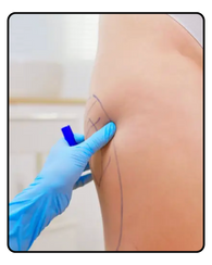 Surgery
