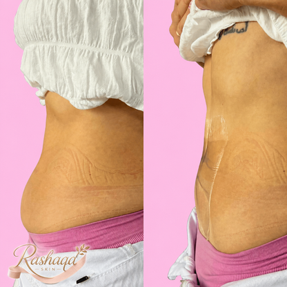 Rashaqa Tummy