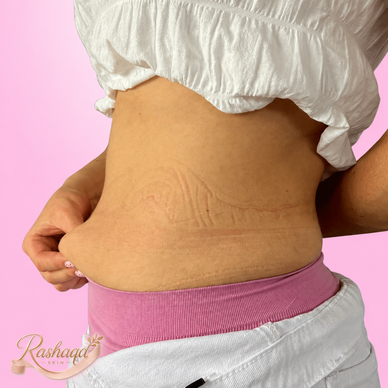 Rashaqa Tummy