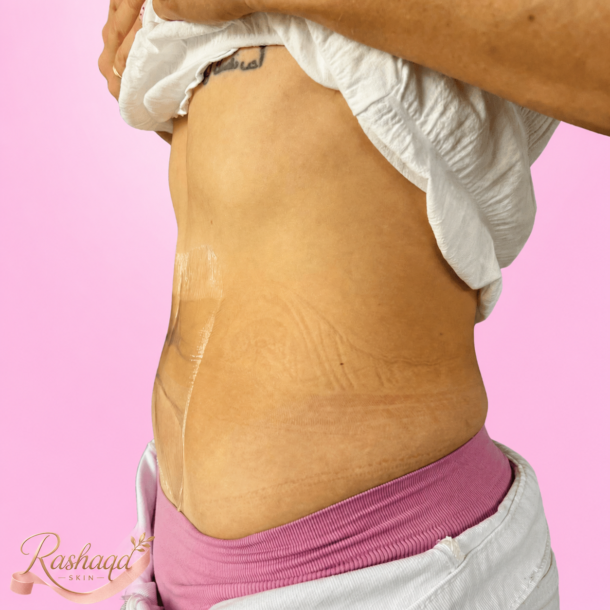 Rashaqa tummy result
