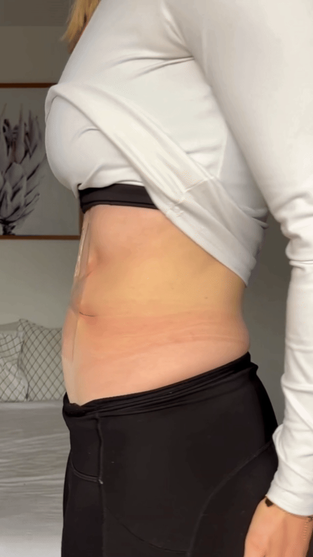 Rashaqa tummy side result