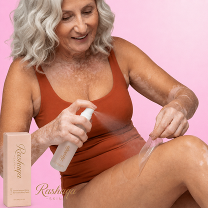 Rashaqa Removal Spray